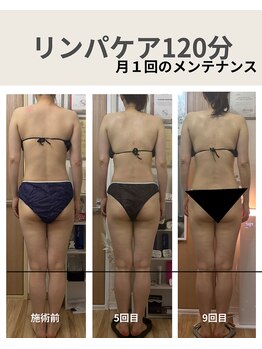 リア(Lia)/30代女性月1回のメンテナンス