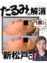クレール 新松戸(Claire)/小顔&肌質改善/小顔リフトアップ