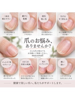 マユネイル(mayunail)の写真/爪のお悩み、諦める前にご相談を。経験豊富なネイリストが爪の状態を見極め、最適なケアをご提案