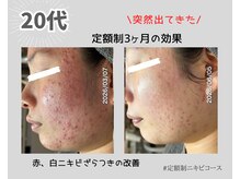 リオル(Rior)の雰囲気（ニキビケア、毛穴美肌、コモデックス他クリスティーナ取扱店）