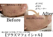 エクラ(eclat)