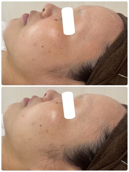 ムー(mu)/ララピール/トーンアップ/ツヤ