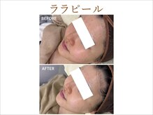 ティアム バイ テトテ 神戸三宮(TIAM by tetote)/ララピール