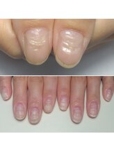 なかやまネイルクリニック/ネイルケア