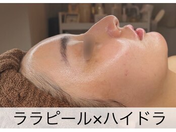 マドモアゼル 麻布十番/ララピール×ハイドラ