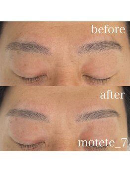 モテテ 名駅店(motete)/お客様施術例☆名駅