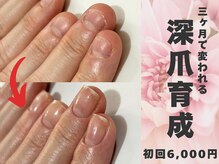 ギフト(GIFT)