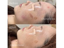 シャルム(Charme.)/