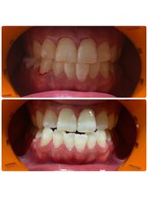 ワイズサロン(Y's salon)/11回終了のbefour after