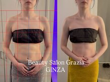 グラツィア 銀座(Grazia)/6回【 ブライダルエステ整体 】