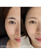 エス 浦添(S)/レディース眉Before&After