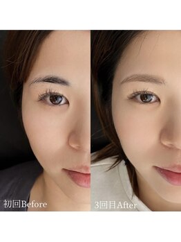 エス 浦添(S)/レディース眉Before&After