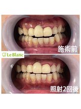 ルブラン 奈良店(Le Blanc)/ご紹介でお越し下さいました！