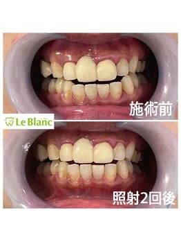 ルブラン 奈良店(Le Blanc)/ご紹介でお越し下さいました!