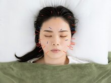 フラット(flat)/小顔美容鍼リフトアップも