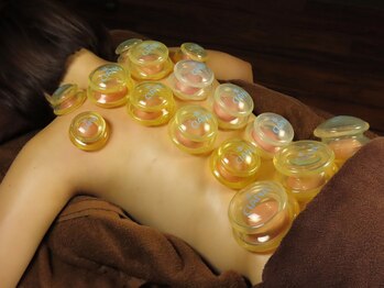 サラン鍼灸院(SARAN都楽鍼灸院)/カッピング(吸玉)