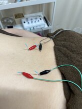 くるまざか鍼灸治療院 上野/パルス鍼・電気鍼