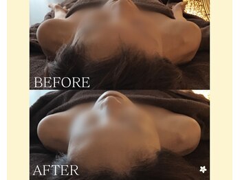 バリマ ビューティー(Bali Ma'beauty)/【ボディ施術】辛い肩凝り解消◎