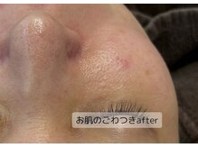 シェリール(Cherir)/肌質改善ベーシック