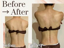 べセラ(BESERA)の雰囲気（before after【フォトギャラリーをご覧ください】）