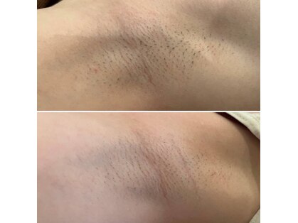 カレン 天神本店の写真