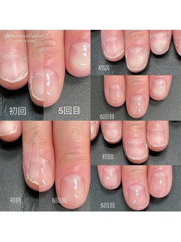 ドットエス(.S)/自爪の育成におススメ!!