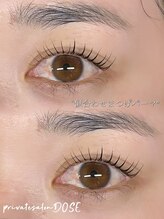 ドース(DOSE)/持ち重視！