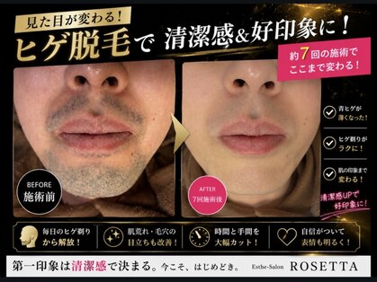 エステサロン ロゼッタ(ROSETTA)の写真