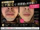 エステサロン ロゼッタ(ROSETTA)の写真