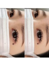 アイリス(eyeris)/フラットラッシュ付け放題