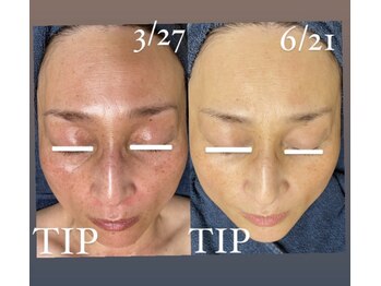 シャルム(charme)/くすみケアもお任せください!