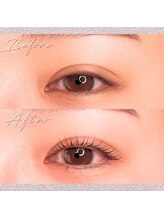 パレット 国立店(Palette)/まつパ☆Before・After