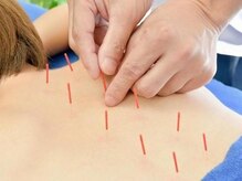 桜琴鍼灸治療院 赤坂店