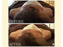 バリマ ビューティー(Bali Ma'beauty)/【ボディ施術】腰痛/むくみ解消