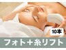バチ上げフェイスライン！！フォトで入れる糸リフト　１０本