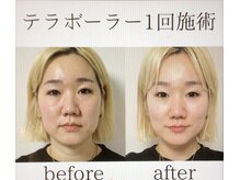 サロン アイミー(salon i me)