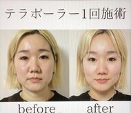 サロン アイミー(salon i me)