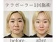 サロン アイミー(salon i me)の写真