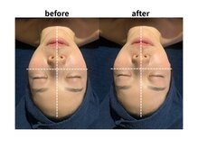 特徴（3）お顔にも嬉しい変化♪