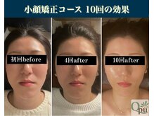 キュープ 表参道店(Qpu)/継続が「小顔」と「美」をつくる