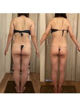 レジュベール(Rejuvel)/リバウンドしない身体へ