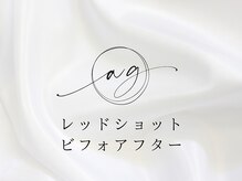 アストリエ グレース 相模大野(Astorie Grace)/レッドショットビフォーアフター