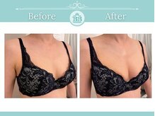 美人バスト 新潟店/ 【バストアップ★育乳】症例