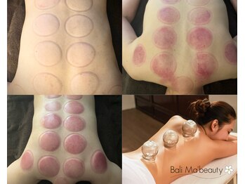 バリマ ビューティー(Bali Ma'beauty)/カッピングとオイルの相性抜群◎