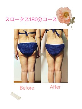 エフクレール(Ef Clair)/スロータス施術ビフォーアフター