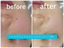 クラリ(Clari)の雰囲気（徹底毛穴洗浄～洗浄後のスペシャルケアまでできるフルコース☆）