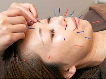 サンゴ(sango)/美容鍼