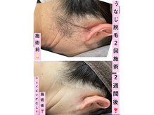 エスポワール(Espoir)の雰囲気（部位別、都度払いOK☆ メンズ◎最新機器にて18歳以下お子様も◎）