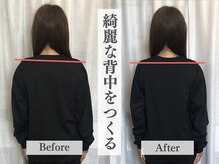 アライメントトウキョウ 麻布十番(Alignment TOKYO)/左右差がお顔にも出る☆