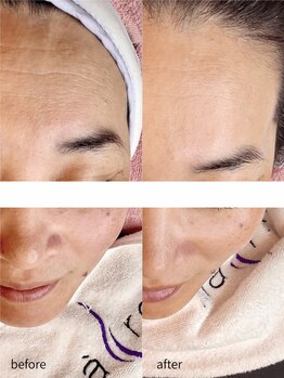 リバース(waxR B S)/乾燥肌の方にもオススメです♪